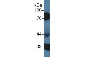 Western Blotting (WB) image for anti-serpin Peptidase Inhibitor, Clade D (Heparin Cofactor), Member 1 (SERPIND1) (AA 276-499) antibody (ABIN7431515)