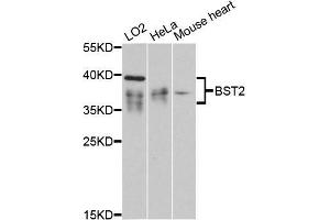 Western blot analysis of extracts of various cell lines, using BST2 antibody (ABIN5997320) at 1:3000 dilution. (BST2 antibody)