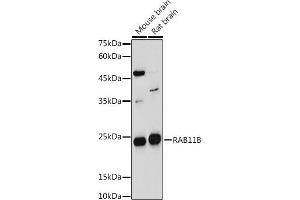 Western blot analysis of extracts of various cell lines, using RB antibody (ABIN7269795) at 1:1000 dilution. (RAB11B antibody  (AA 130-215))