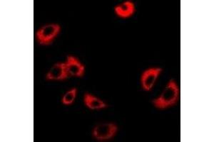 Immunofluorescent analysis of NUP62 staining in Jurkat cells. (NUP62 antibody)