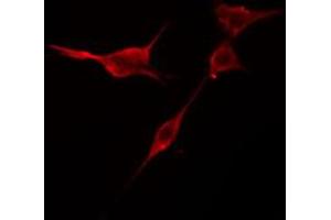 ABIN6274419 staining NIH-3T3 cells by IF/ICC. (TRIM59 antibody  (Internal Region))