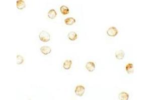 Immunocytochemistry of JMJD3 in K562 cells with JMJD3 antibody at 2. (Kdm6b antibody  (N-Term))