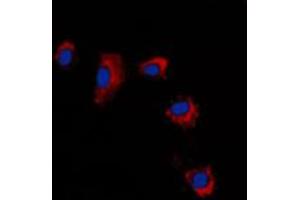 Immunofluorescent analysis of Claudin 2 staining in A431 cells. (Claudin 2 antibody  (C-Term))
