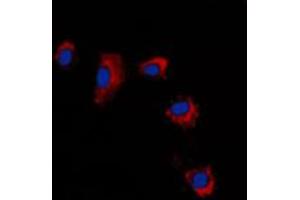 Immunofluorescent analysis of Claudin 2 staining in A431 cells.