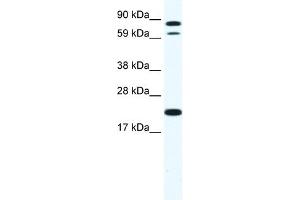WB Suggested Anti-ZFP287 Antibody Titration:  1.