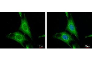 ICC/IF Image WNT10A antibody [N1C1-2] detects WNT10A protein at cytoplasm by immunofluorescent analysis. (WNT10A antibody  (Center))