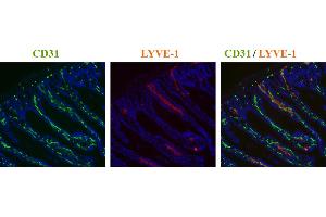 Immunohistochemistry detection of endogenous LYVE-1 in cryo sections of mouse colon carcinoma using anti-LYVE-1, pAb  (red) and anti-mouse CD31 pAb (green). (LYVE1 antibody  (AA 24-228))