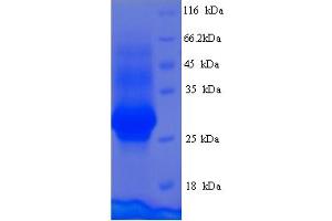 Cementum Protein 1 (CEMP1) (AA 1-247), (full length) protein (His tag)