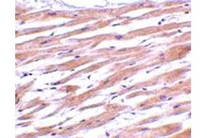Immunohistochemistry of UNG in human heart tissue with UNG polyclonal antibody  at 2 ug/mL . (UNG antibody  (C-Term))