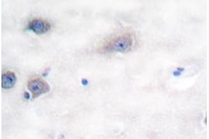 Image no. 2 for anti-Tyrosine Hydroxylase (TH) antibody (ABIN271856) (Tyrosine Hydroxylase antibody)
