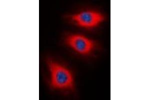 Immunofluorescent analysis of Caldesmon (pS789) staining in HeLa cells. (Caldesmon antibody  (C-Term, pSer789))