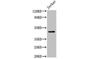 Western Blot Positive WB detected in: Jurkat whole cell lysate All lanes: LPXN antibody at 2 μg/mL Secondary Goat polyclonal to rabbit IgG at 1/50000 dilution Predicted band size: 44 kDa Observed band size: 44 kDa