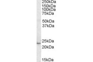 Western Blotting (WB) image for anti-Kruppel-Like Factor 16 (KLF16) (C-Term) antibody (ABIN2465875) (KLF16 antibody  (C-Term))