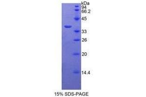 SDS-PAGE (SDS) image for Periplakin (PPL) (AA 1439-1716) protein (His tag) (ABIN2126266)