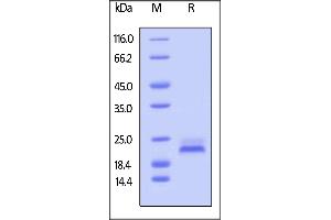 SDS-PAGE (SDS) image for Tumor Necrosis Factor Receptor Superfamily, Member 10b (TNFRSF10B) (AA 56-182) (Active) protein (His tag,AVI tag,Biotin) (ABIN3137686)