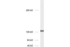 dilution: 1 : 1000; sample: rat hippocampus homogenate