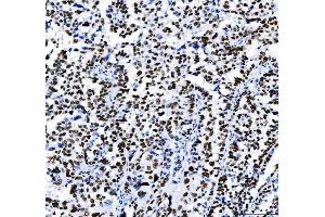 IHC analysis of HDAC2 using anti-HDAC2 antibody (ABIN7601564).