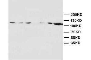 Anti-NMDAR1 antibody, Western blotting Lane 1: Rat Brain Tissue Lysate Lane 2: Rat Brain Tissue Lysate Lane 3: Rat Liver Tissue Lysate Lane 4: Rat Heart Tissue Lysate Lane 5: MM453 Cell Lysate Lane 6: MM231 Cell Lysate Lane 7: HELA Cell Lysate (GRIN1/NMDAR1 antibody  (N-Term))