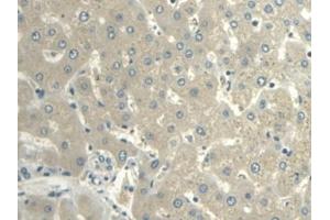 Detection of VF in Human Liver Tissue using Polyclonal Antibody to Visfatin (VF) (NAMPT antibody  (AA 1-491))