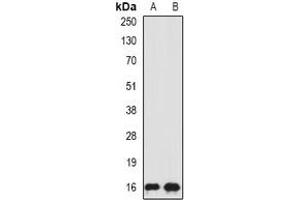 Western blot analysis of SRP19 expression in HepG2 (A), MCF7 (B) whole cell lysates.