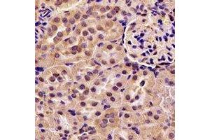 Immunohistochemical analysis of ACAA1 staining in rat kidney formalin fixed paraffin embedded tissue section. (ACAA1 antibody)