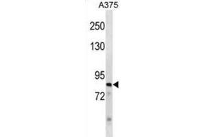 Western Blotting (WB) image for anti-Zinc Finger Protein 148 (ZNF148) antibody (ABIN3000952) (ZNF148 antibody)