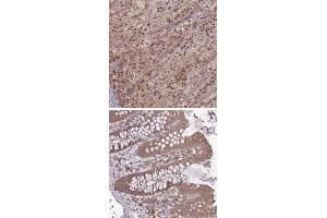Immunohistochemical staining of human colon with TIGD7 polyclonal antibody  shows moderate cytoplasmic positivity in glandular cells. (TIGD7 antibody)
