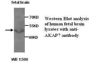 Image no. 1 for anti-A Kinase (PRKA) Anchor Protein 7 (AKAP7) antibody (ABIN1574566)