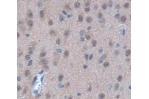 Used in DAB staining on fromalin fixed paraffin- embedded Kidney tissue (STK3 antibody  (AA 235-460))
