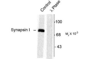 Image no. 1 for anti-Synapsin I (SYN1) (pSer603) antibody (ABIN372721) (SYN1 antibody  (pSer603))