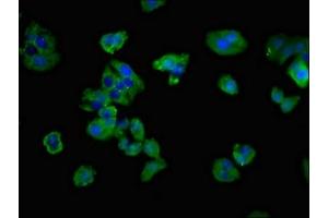 Immunofluorescent analysis of HepG2 cells using ABIN7171390 at dilution of 1:100 and Alexa Fluor 488-congugated AffiniPure Goat Anti-Rabbit IgG(H+L) (CD3G antibody  (AA 138-182))