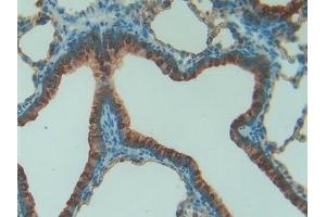 Detection of SFTPA1 in Rat Lung Tissue using Polyclonal Antibody to Pulmonary Surfactant Associated Protein A1 (SFTPA1) (Surfactant Protein A1 antibody  (AA 21-248))