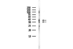 Western blot analysis of lysates from Mouse brain, using UNG Antibody at 1/1000 dilution.