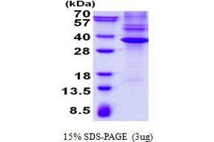 Image no. 1 for NK3 Homeobox 1 (NKX3-1) protein (His tag) (ABIN1098730) (NKX3-1 Protein (His tag))