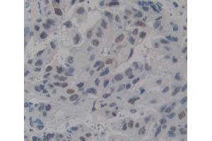 Used in DAB staining on fromalin fixed paraffin- embedded breast tissue (TDP1 antibody  (AA 4-215))