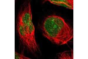 Immunofluorescent staining of U-2 OS with MINA polyclonal antibody  (Green) shows positivity in nucleus and nucleoli. (MINA antibody)