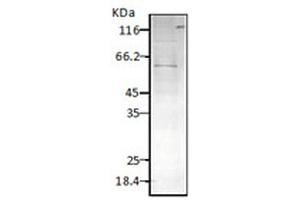 Western blot analysis of Parasite Lysates showing detection of HSP60 protein using Rabbit Anti-HSP60 Polyclonal Antibody . (HSPD1 antibody  (FITC))