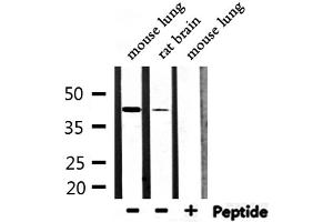 Western blot analysis of extracts from mouse lung, rat brain, using M-CK Antibody. (CKM antibody  (N-Term))