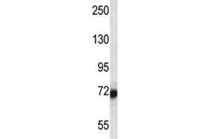 SP100 antibody western blot analysis in ZR-75-1 lysate. (SP100 antibody  (AA 199-227))