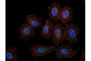 Immunocytochemistry staining of Csk in human HeLa cell line using anti-Csk (CSK-04, green). (CSK antibody  (AA 330-450))