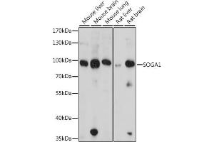 Western blot analysis of extracts of various cell lines, using SOG antibody (6597) at 1:1000 dilution. (SOGA1 antibody  (AA 650-750))