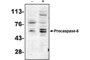 Western Blotting (WB) image for anti-Caspase 6, Apoptosis-Related Cysteine Peptidase (CASP6) antibody (ABIN264405) (Caspase 6 antibody)