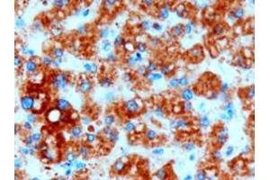 ABIN190849 (3µg/ml) staining of paraffin embedded Human Liver. (DGAT2 antibody  (Internal Region))