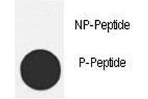 Dot Blot (DB) image for anti-Mdm2, p53 E3 Ubiquitin Protein Ligase Homolog (Mouse) (MDM2) (pThr218) antibody (ABIN3031737)