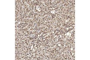 IHC analysis of U1A/SNRPA using anti-U1A/SNRPA antibody (ABIN7600891). (SNRPA1 antibody  (AA 25-218))