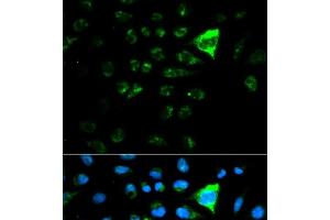 Immunofluorescence analysis of MCF-7 cells using CDKN1A Polyclonal Antibody (p21 antibody)