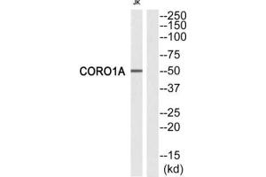 Western Blotting (WB) image for anti-Coronin, Actin Binding Protein, 1A (CORO1A) (Internal Region) antibody (ABIN1849308) (Coronin 1a antibody  (Internal Region))