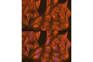 Immunofluorescence analysis of U-2 OS cells using PFKM Rabbit pAb (ABIN6132211, ABIN6145488, ABIN6145489 and ABIN6221141) at dilution of 1:100 (40x lens). (PFKM antibody  (AA 501-780))