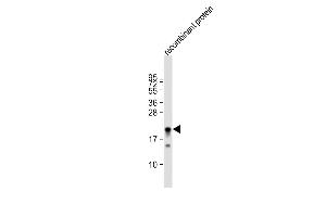 Anti-MLL2 Antibody  at 1:80000 dilution + recombinant protein whole cell lysate Lysates/proteins at 20 μg per lane.