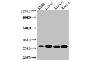 Western Blot Positive WB detected in: K562 whole cell lysate, Mouse liver tissue, Mouse kidney tissue, Mouse brain tissue All lanes: QDPR antibody at 3 μg/mL Secondary Goat polyclonal to rabbit IgG at 1/50000 dilution Predicted band size: 26, 23 kDa Observed band size: 26 kDa (QDPR antibody  (AA 2-244))